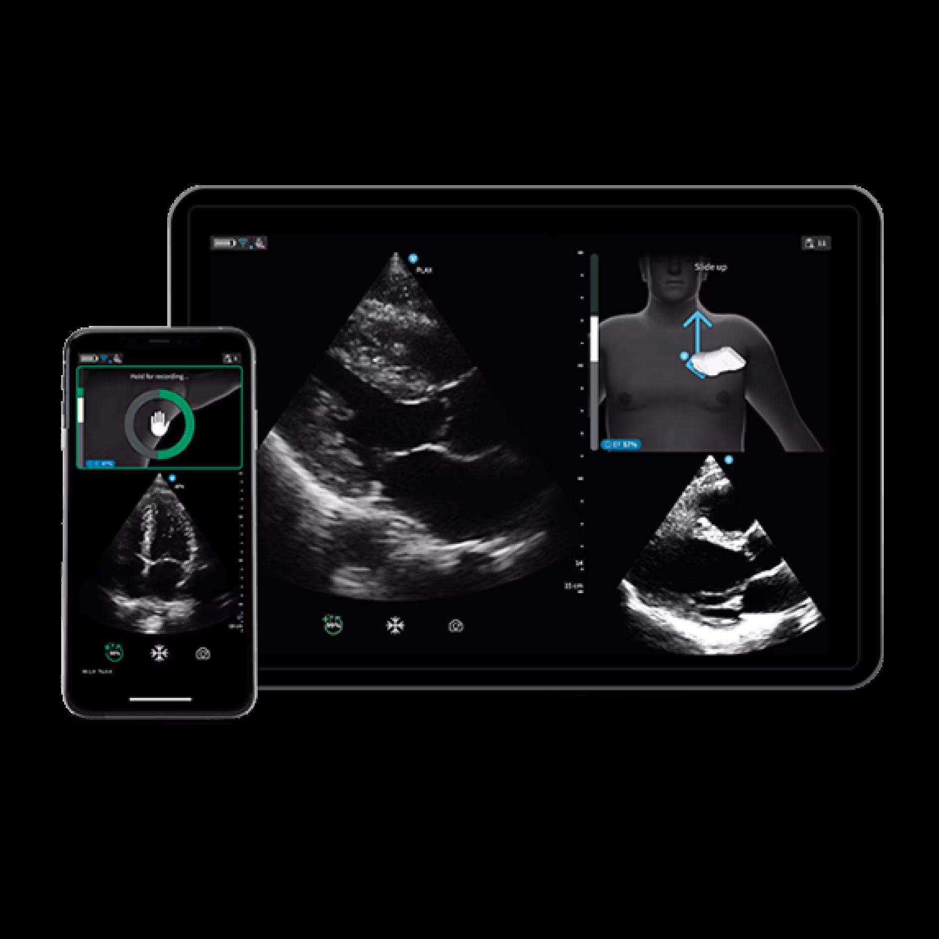 Vscan Air IB Offering Vscan Air IB Offering