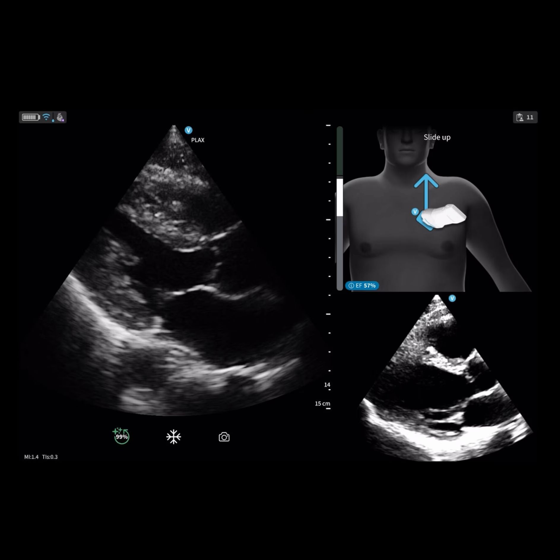 Vscan Air IB Offering Vscan Air IB Offering