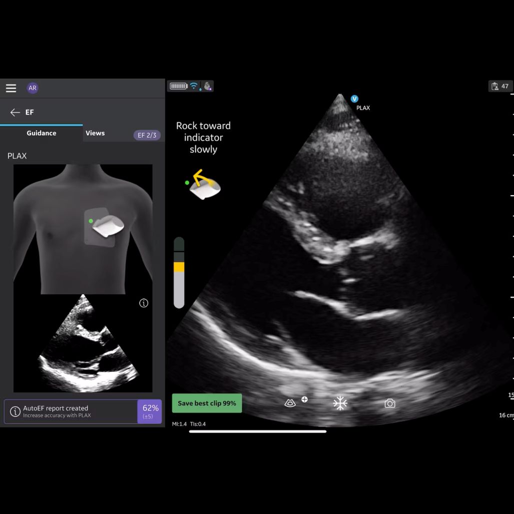 Vscan Air IB Offering Vscan Air IB Offering