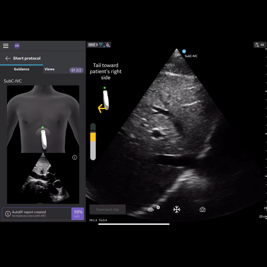 Vscan Air IB Offering Vscan Air IB Offering