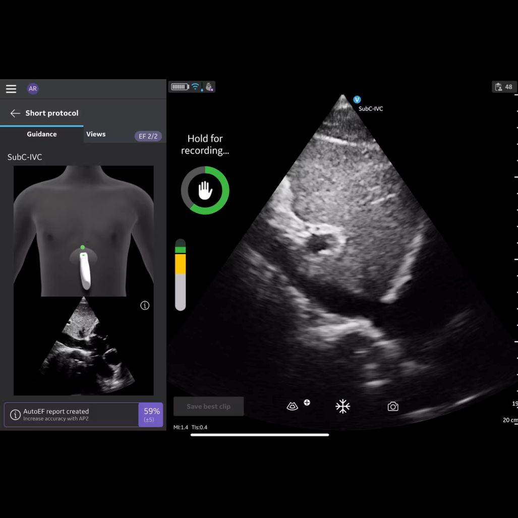 Vscan Air IB Offering Vscan Air IB Offering