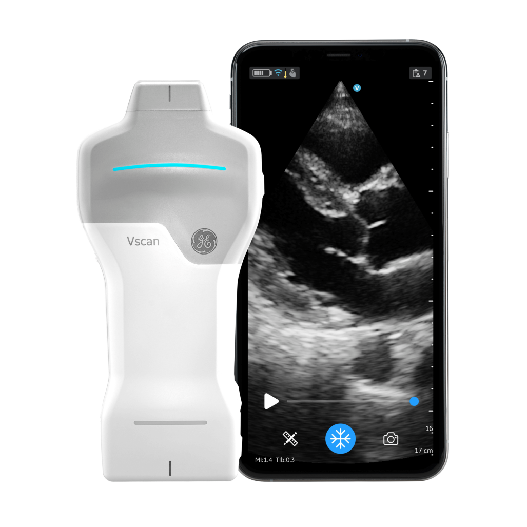 Vscan Air™ SL R3 Vscan Air™ SL R3