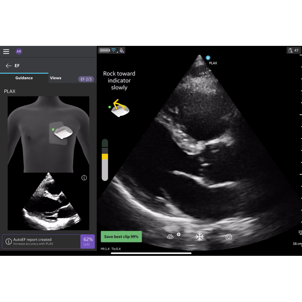 Vscan Extend Dual R2