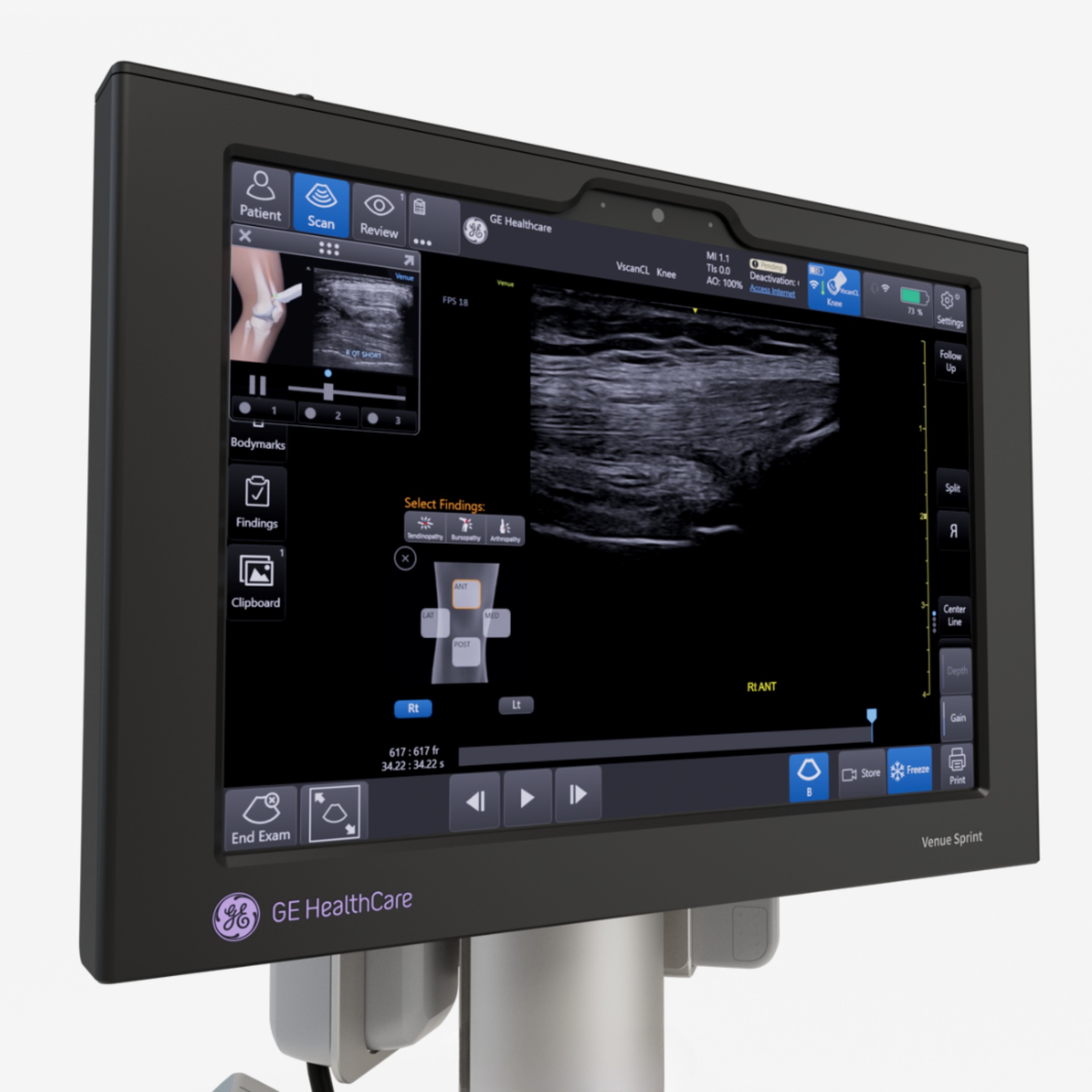 Venue Sprint™ Venue Sprint™